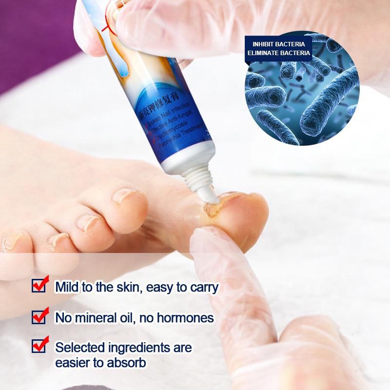 SUMIFUN NAIL FUNGUS TREATMENT CREAM Suzillicious Collections